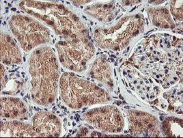 AGPAT5 Antibody in Immunohistochemistry (Paraffin) (IHC (P))