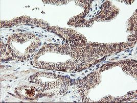 AGPAT5 Antibody in Immunohistochemistry (Paraffin) (IHC (P))