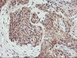 AGPAT5 Antibody in Immunohistochemistry (Paraffin) (IHC (P))