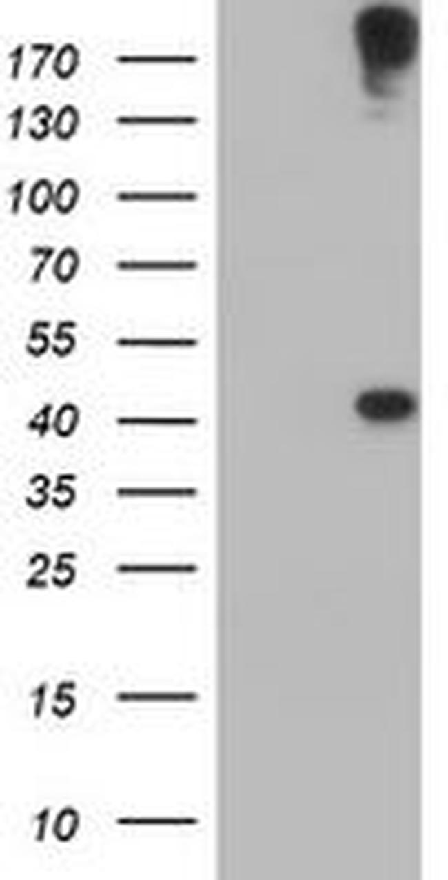 AGPAT5 Antibody in Western Blot (WB)