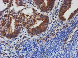 TULP3 Antibody in Immunohistochemistry (Paraffin) (IHC (P))