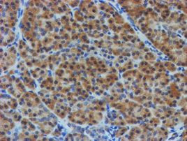 TULP3 Antibody in Immunohistochemistry (Paraffin) (IHC (P))