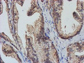 TULP3 Antibody in Immunohistochemistry (Paraffin) (IHC (P))