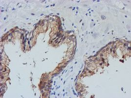 TULP3 Antibody in Immunohistochemistry (Paraffin) (IHC (P))