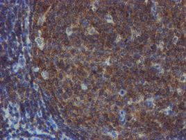 TULP3 Antibody in Immunohistochemistry (Paraffin) (IHC (P))