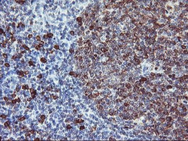 J Chain Antibody in Immunohistochemistry (Paraffin) (IHC (P))