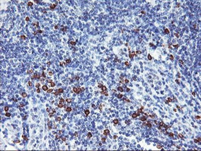 J Chain Antibody in Immunohistochemistry (Paraffin) (IHC (P))