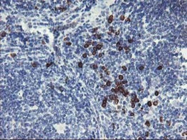 J Chain Antibody in Immunohistochemistry (Paraffin) (IHC (P))