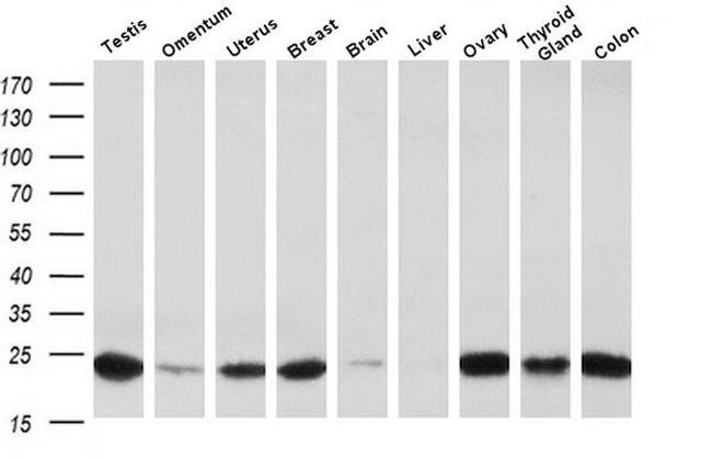 J Chain Antibody in Western Blot (WB)