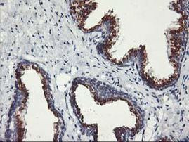 Kir3.1 (KCNJ3) Antibody in Immunohistochemistry (Paraffin) (IHC (P))