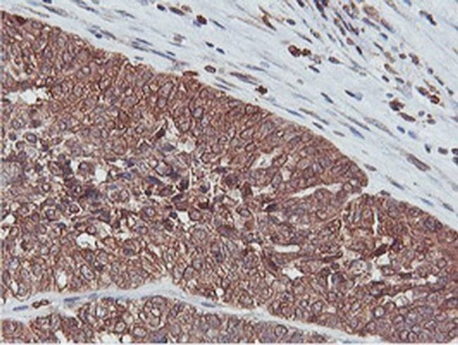 C20orf3 Antibody in Immunohistochemistry (Paraffin) (IHC (P))