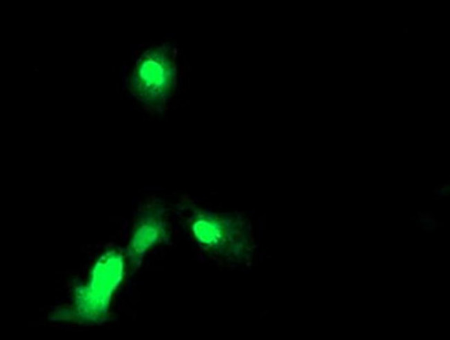 EXOSC7 Antibody in Immunocytochemistry (ICC/IF)