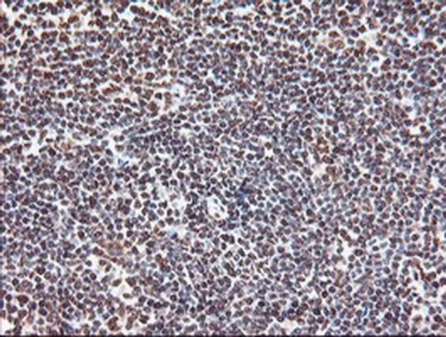 EXOSC7 Antibody in Immunohistochemistry (Paraffin) (IHC (P))