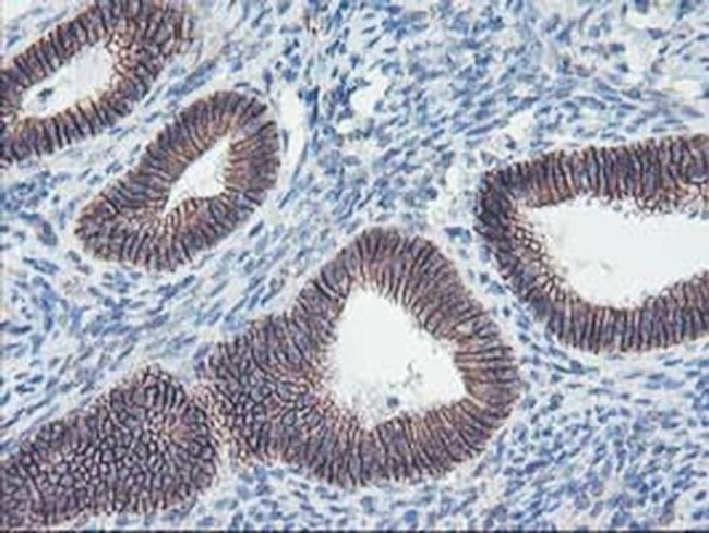 ALOX15 Antibody in Immunohistochemistry (Paraffin) (IHC (P))