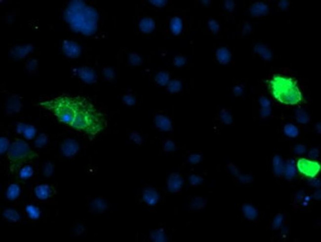 CD249 Antibody in Immunocytochemistry (ICC/IF)