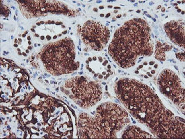 CD249 Antibody in Immunohistochemistry (Paraffin) (IHC (P))