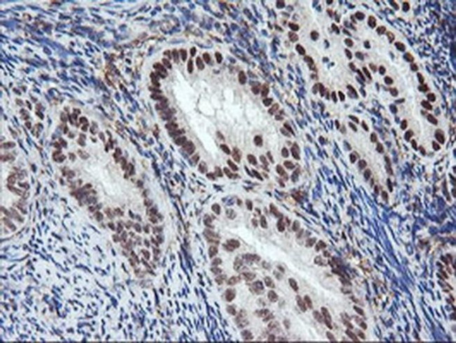 CD249 Antibody in Immunohistochemistry (Paraffin) (IHC (P))