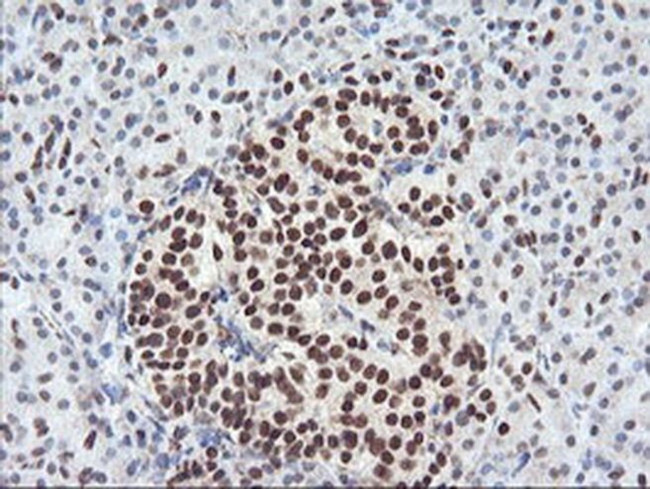 CD249 Antibody in Immunohistochemistry (Paraffin) (IHC (P))