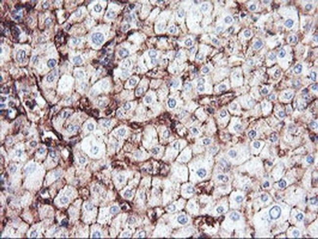 CD249 Antibody in Immunohistochemistry (Paraffin) (IHC (P))