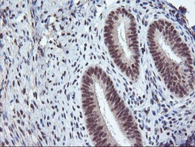 CD249 Antibody in Immunohistochemistry (Paraffin) (IHC (P))