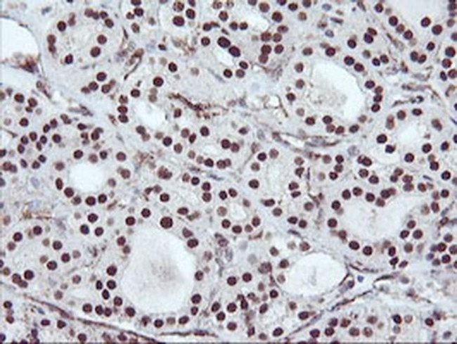 CD249 Antibody in Immunohistochemistry (Paraffin) (IHC (P))