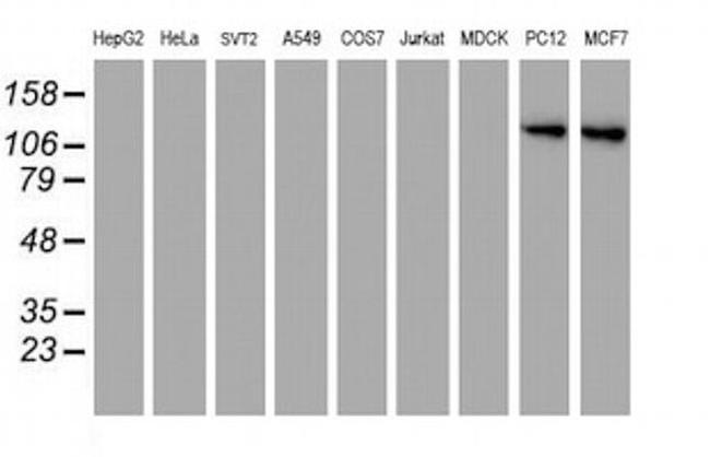 CD249 Antibody in Western Blot (WB)