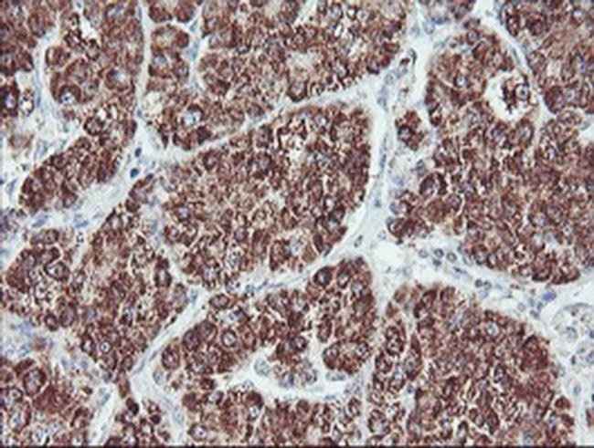 PECI Antibody in Immunohistochemistry (Paraffin) (IHC (P))