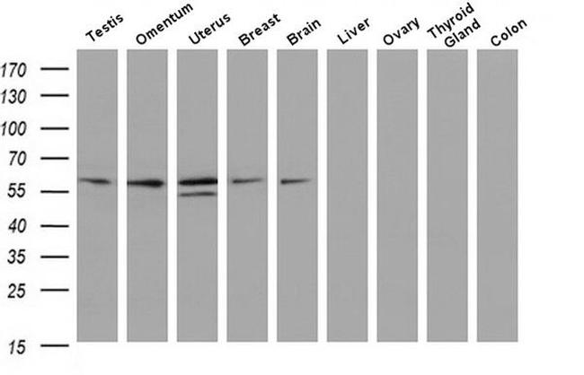 Iduronate 2 Sulfatase Antibody in Western Blot (WB)