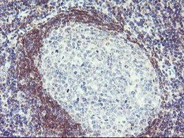 Pallidin Antibody in Immunohistochemistry (Paraffin) (IHC (P))