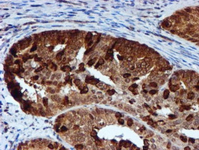 RUVBL2 Antibody in Immunohistochemistry (Paraffin) (IHC (P))