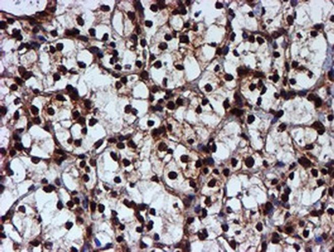 RUVBL2 Antibody in Immunohistochemistry (Paraffin) (IHC (P))