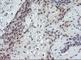 GADD34 Antibody in Immunohistochemistry (Paraffin) (IHC (P))