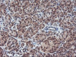 GADD34 Antibody in Immunohistochemistry (Paraffin) (IHC (P))