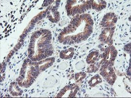 GADD34 Antibody in Immunohistochemistry (Paraffin) (IHC (P))