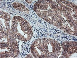 GADD34 Antibody in Immunohistochemistry (Paraffin) (IHC (P))