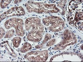 GADD34 Antibody in Immunohistochemistry (Paraffin) (IHC (P))