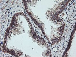 GADD34 Antibody in Immunohistochemistry (Paraffin) (IHC (P))