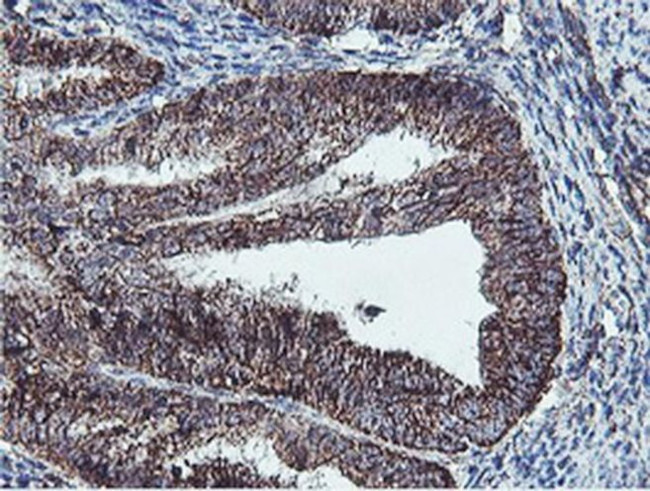 REEP2 Antibody in Immunohistochemistry (Paraffin) (IHC (P))