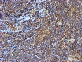 PSMB9 Antibody in Immunohistochemistry (Paraffin) (IHC (P))