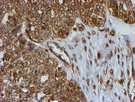 PSMB9 Antibody in Immunohistochemistry (Paraffin) (IHC (P))