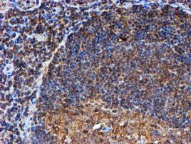 PSMB9 Antibody in Immunohistochemistry (Paraffin) (IHC (P))