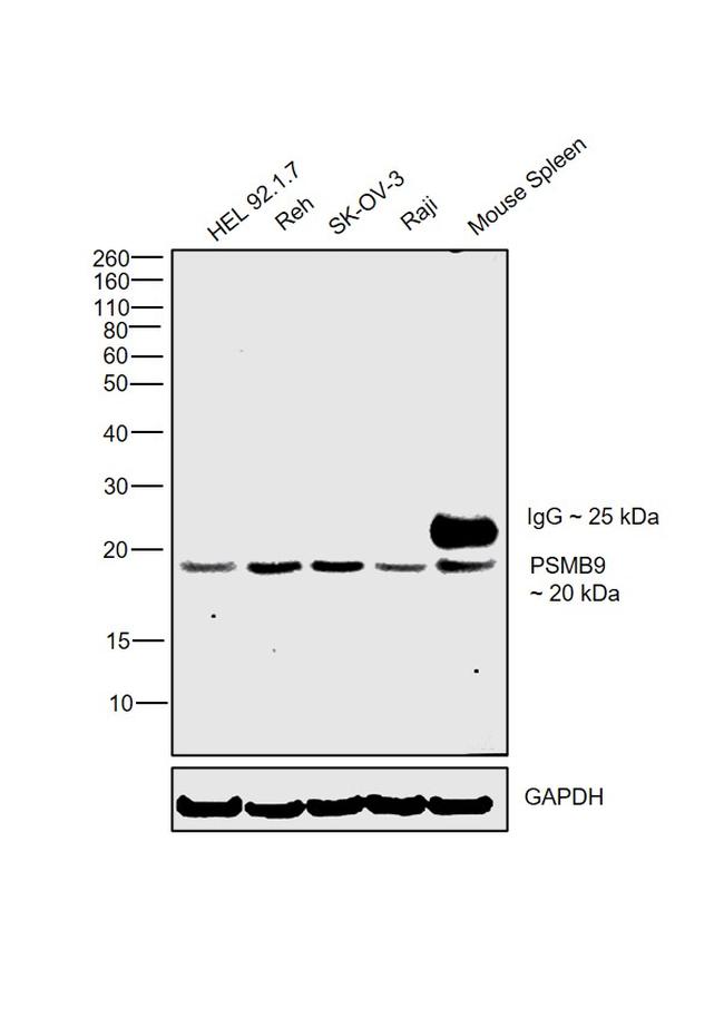 PSMB9 Antibody in Western Blot (WB)