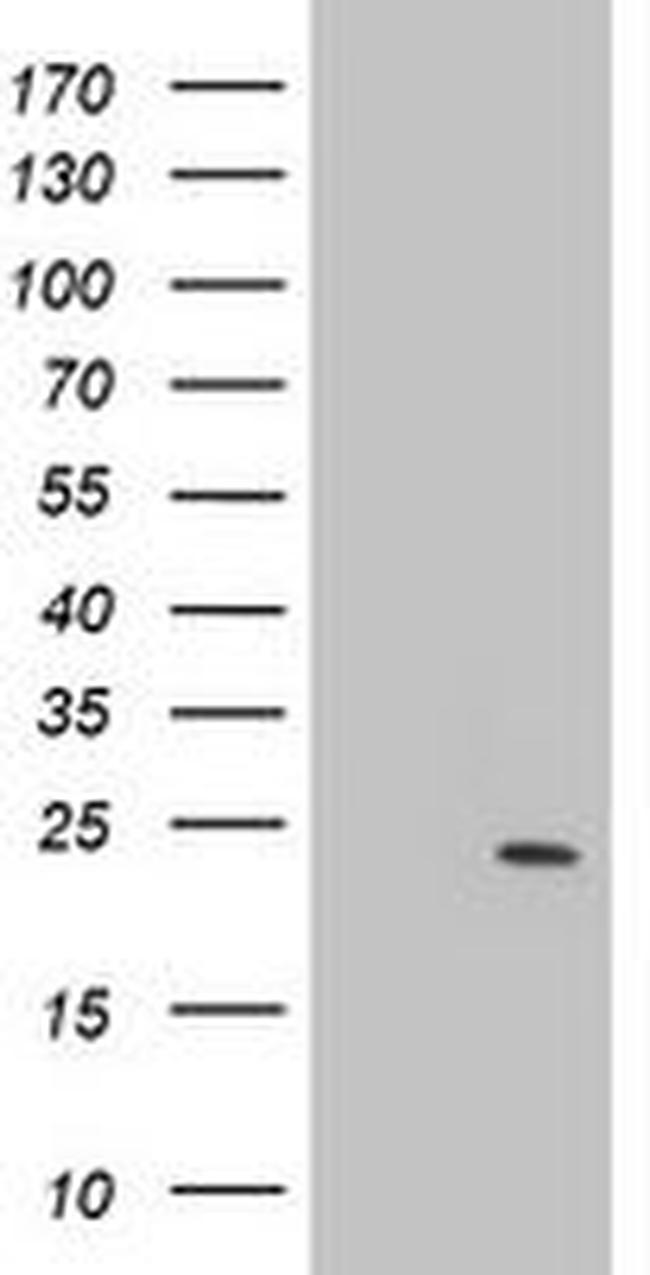 PSMB9 Antibody in Western Blot (WB)