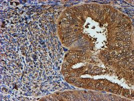 PSMB9 Antibody in Immunohistochemistry (Paraffin) (IHC (P))