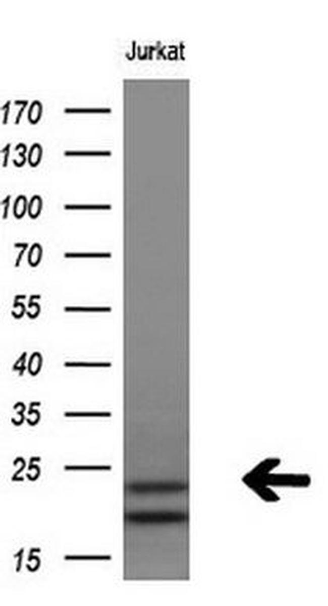 PSMB9 Antibody in Western Blot (WB)