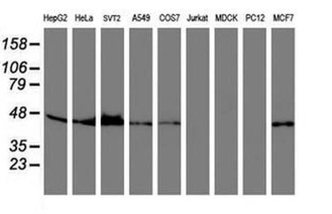 SERPINB6 Antibody in Western Blot (WB)