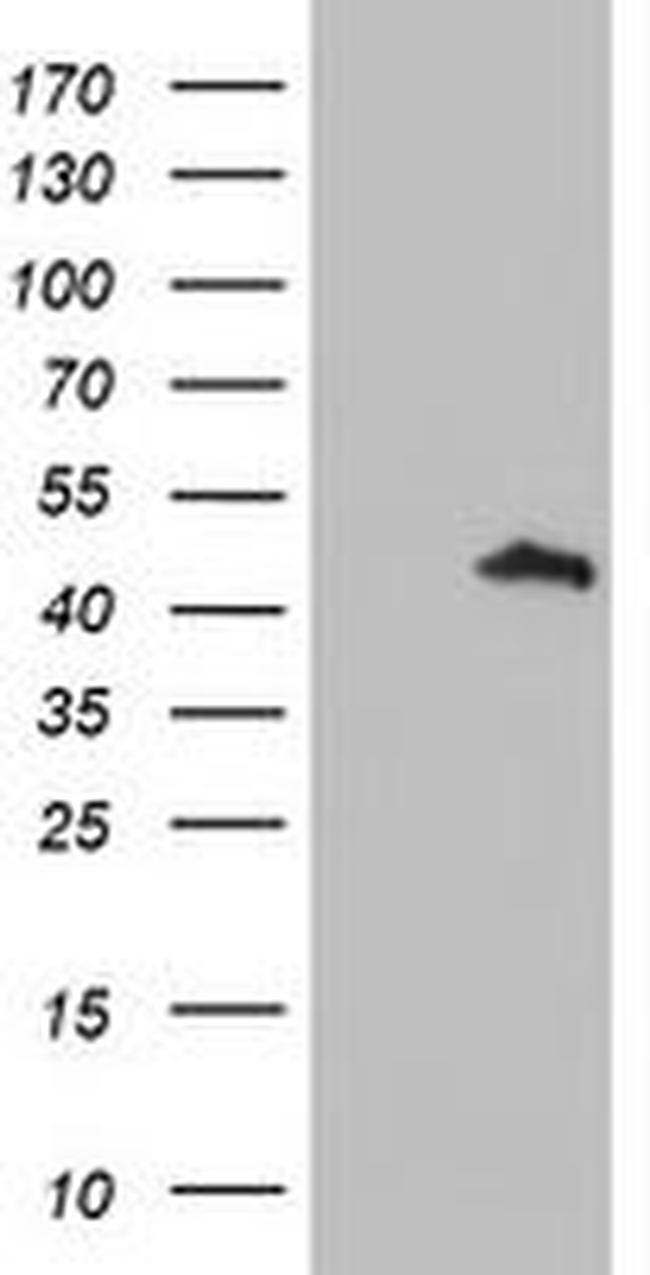 SERPINA5 Antibody in Western Blot (WB)