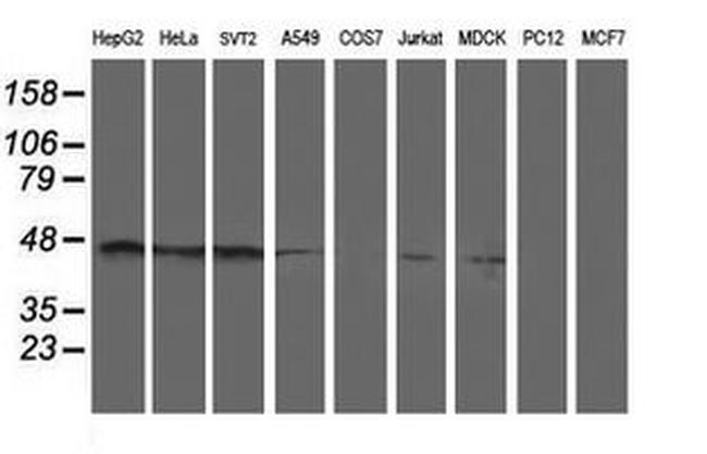 SERPINA5 Antibody in Western Blot (WB)