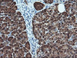 BCAT1 Antibody in Immunohistochemistry (Paraffin) (IHC (P))