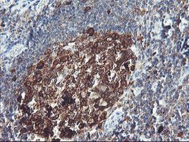 BCAT1 Antibody in Immunohistochemistry (Paraffin) (IHC (P))